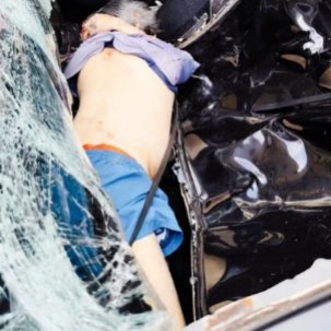 Warga Diduga Lompat dari Lantai 30 Apartemen North Land Ancol, Meninggal di Tempat
