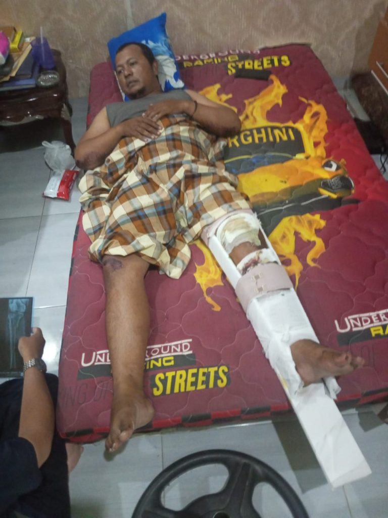 Kabel Internet Wifi Jalur Perumahan Permata Asri Desa Karang Anyar Mencederai Pengemudi Bermotor Hingga Patah Tulang dibagian Kaki Korban